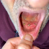 Özel Dent Ekol Ağız Diş Sağlığı Merkezi Çiğli Babamın Ağzını Mahvetti!