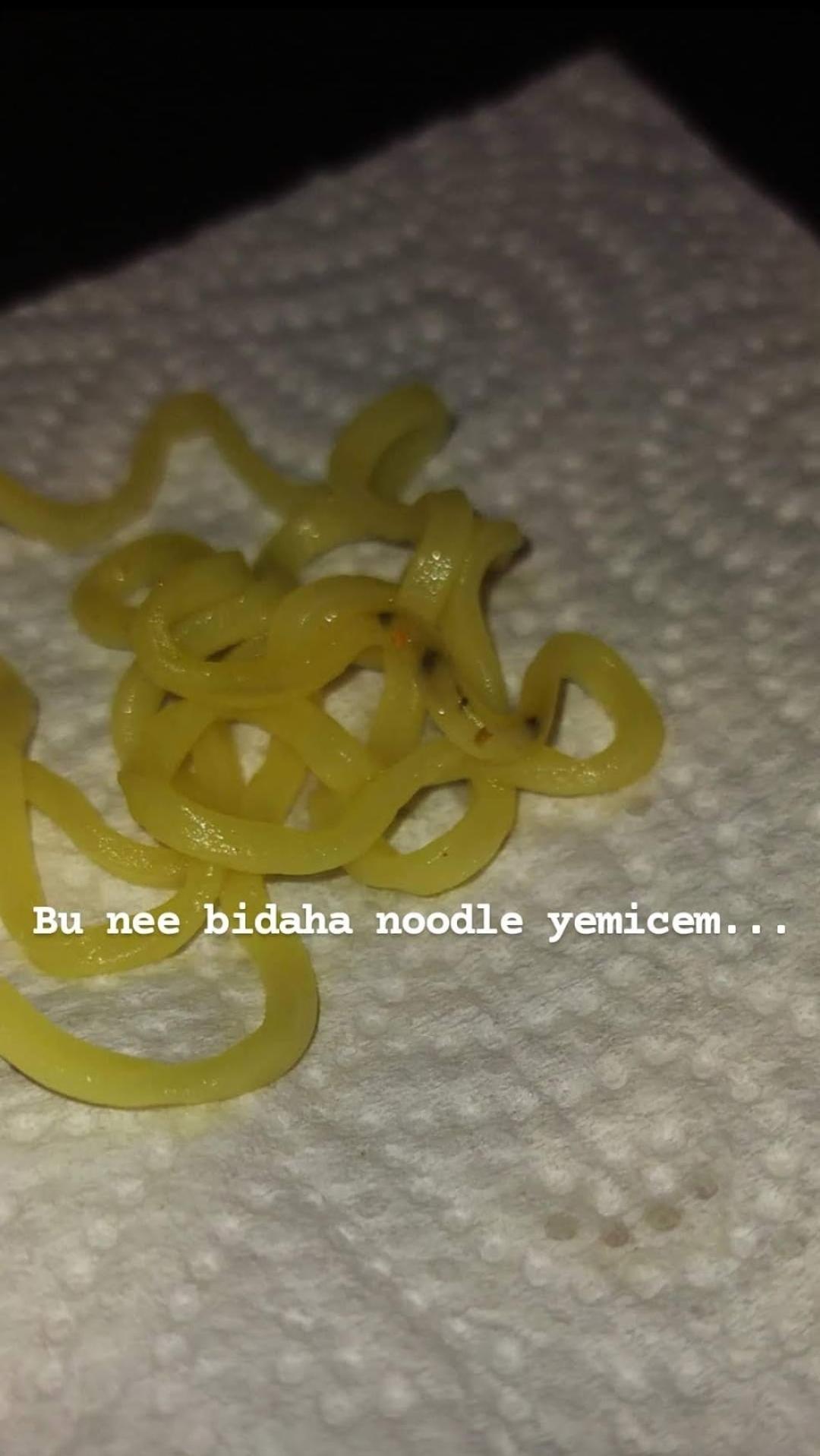 İndomie Noodle İçinde Siyahlık Şikayetvar