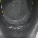 Skechers Ayakkabı Deformasyonu Firmanın Ürününün Arkasında Durmaması