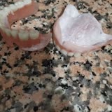 TOBB ETÜ Hastanesi TOBB Hastanesinin Yaptığı Kireçlenen Diş Protezleri