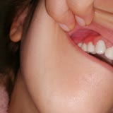 Estetik Diş Hekimim Korkunç Bir Klinik