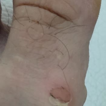 Depderi Müşteri Memnuniyeti Sıfır!