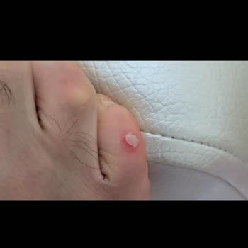 Depderi Müşteri Memnuniyeti Sıfır!