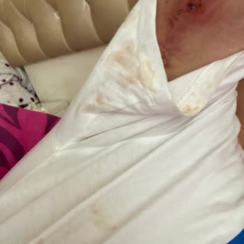 Estethica Mağduriyetim Yanlış İşlemler Ve Arkasında Durulmayan Sözler