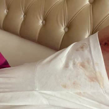 Estethica Mağduriyetim Yanlış İşlemler Ve Arkasında Durulmayan Sözler