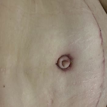 Estethica Mağduriyetim Yanlış İşlemler Ve Arkasında Durulmayan Sözler