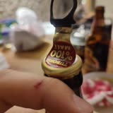 Tuborg Bira Kapağını Açarken Parmağımın Kesilmesi