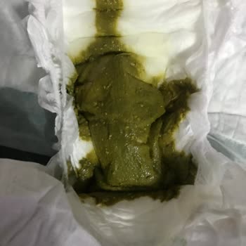 Aptamil Prosyneo Yeşil Kaka