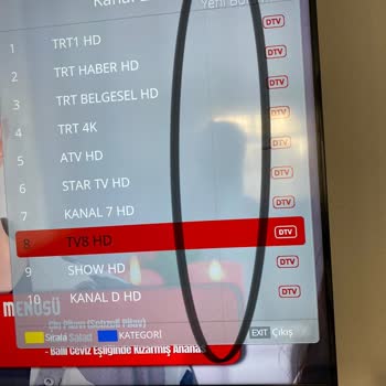 Grundig Revizyonlu Televizyonum Çözülmesi