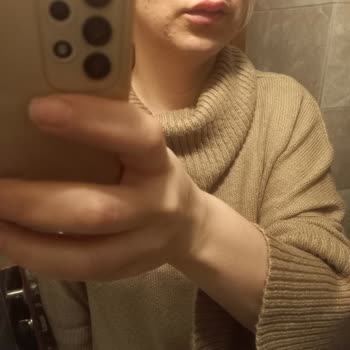 Procsin Asit Dökülmüş Gibi Cildimi Yaktı