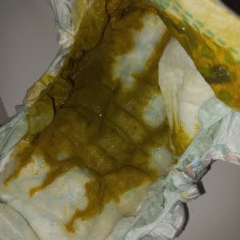 Aptamil Prosyneo Mama