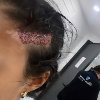 Estethica 'da Yapılan Ameliyatım Olumsuz Oldu