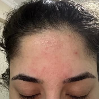 La Roche - Posay Mikro Soyucu Tonik