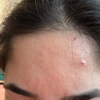 La Roche - Posay Mikro Soyucu Tonik