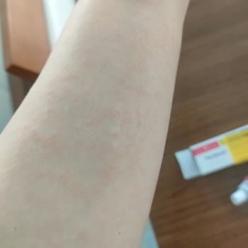 Abdi İbrahim Factive Mahvetti