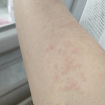 Abdi İbrahim Factive Mahvetti