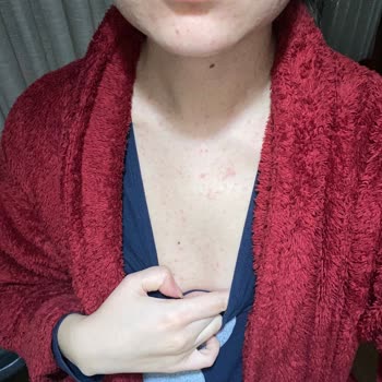 Abdi İbrahim Factive İlacı Alerji