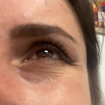 Neutrogena Retinol Boost Göz Kremi Göz Altlarımı Mahvetti!