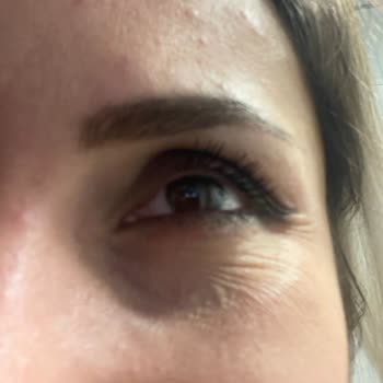 Neutrogena Retinol Boost Göz Kremi Göz Altlarımı Mahvetti!