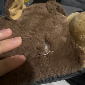 Twigy Dikişi Yırtıldı