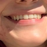 Karşıyaka Ağız Ve Diş Sağlığı Merkezi Dişçi Dişimi Yamulttu