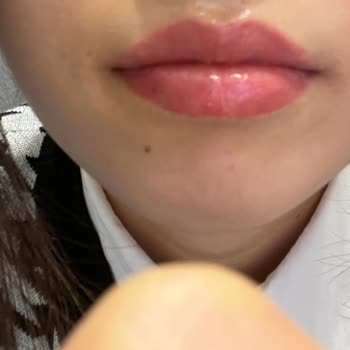 Bellaclinic&nbsp;Dudak Dolgusu Etkisiz