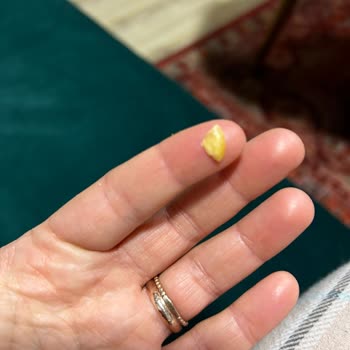 Karagöz Baklavaları Baklavanın İçinde Yabancı Madde