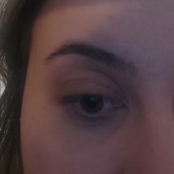 Dermoskin Be Bright Peptit Krem Mağduriyeti