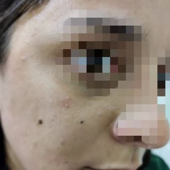 Sebamed Likit Yüz Ve Vücut Jeli