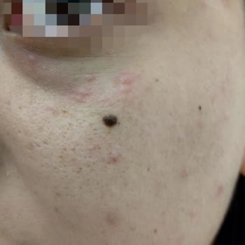 Sebamed Likit Yüz Ve Vücut Jeli