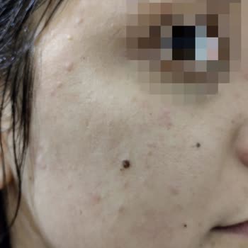 Sebamed Likit Yüz Ve Vücut Jeli