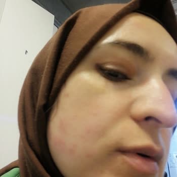 Rise & Shine Ürünün Yan Etkileri