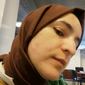 Rise & Shine Ürünün Yan Etkileri