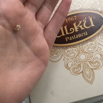 Ülkü Pastanesinden Yumurta Kabuğu