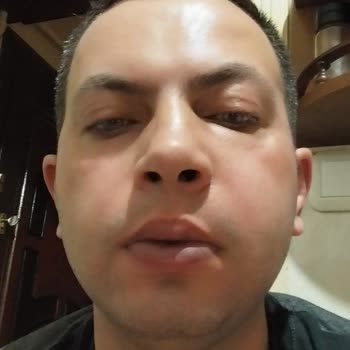 Türk Eczacılar Birliği Farklı Marka Antibiyotik Verilmesi