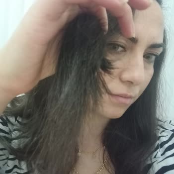 Remington Marka S8540 Saçlarımı Yaktı