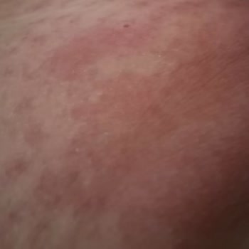 Vega Hospital Hastalığa Tedavi Bulamadılar Umurlarında Bile Olmadı