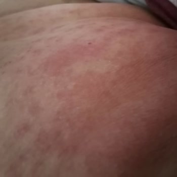 Vega Hospital Hastalığa Tedavi Bulamadılar Umurlarında Bile Olmadı