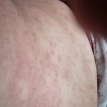 Vega Hospital Hastalığa Tedavi Bulamadılar Umurlarında Bile Olmadı