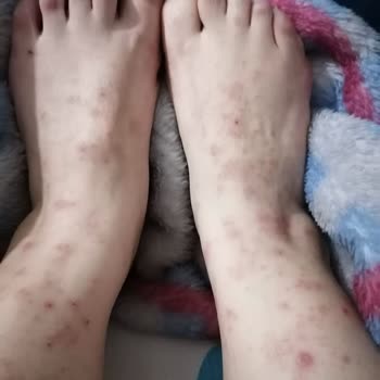 Vega Hospital Hastalığa Tedavi Bulamadılar Umurlarında Bile Olmadı