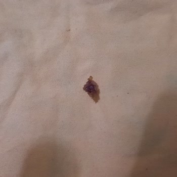 Nutella 630 Gr İçinden Çıkan Yabancı Madde