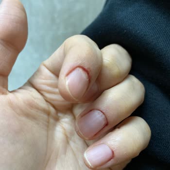 Duygu Acar Beauty Center Manikür Yaptıkları Tırnaklarım Kan İçinde Kaldı