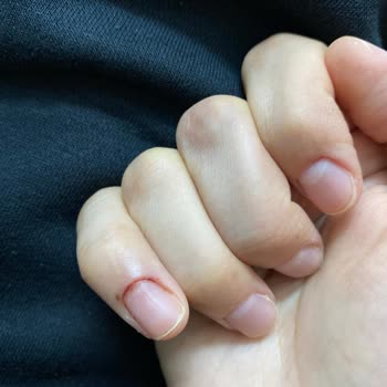 Duygu Acar Beauty Center Manikür Yaptıkları Tırnaklarım Kan İçinde Kaldı