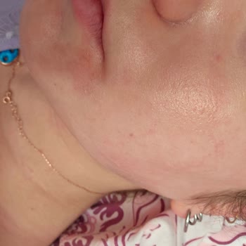 Seda Altın (BSA Grup Danışmanlık) Altın Kil Maskesi Yanma ve Kızarıklık Yaptı