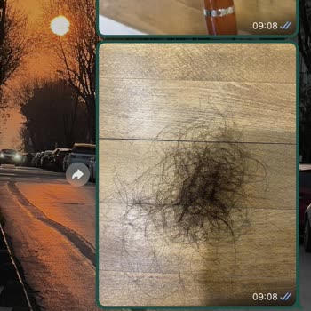 Hairplus Saçın 2 Ay İçinde Dökülmesi