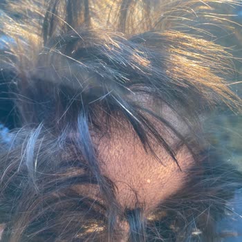 Hairplus Saçın 2 Ay İçinde Dökülmesi