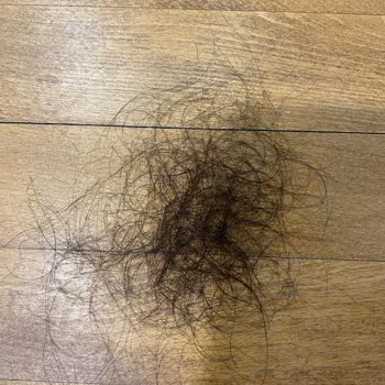 Hairplus Saçın 2 Ay İçinde Dökülmesi