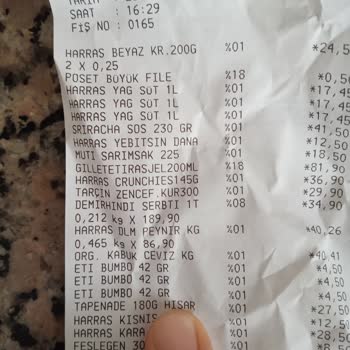 Anatolia Food Üründen Saç Teli Çıktı