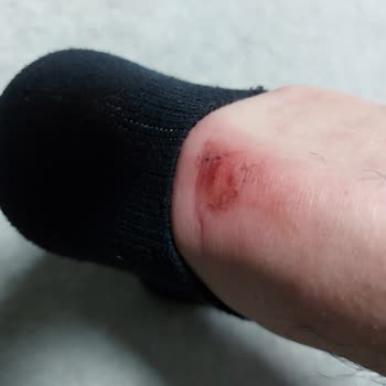 adidas Rende Taksam Ayağıma Daha Az Zarar Verirdi