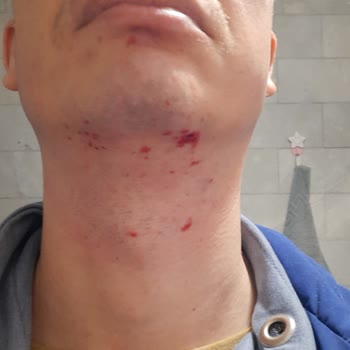 Derby Suratım ParamParça Oldu